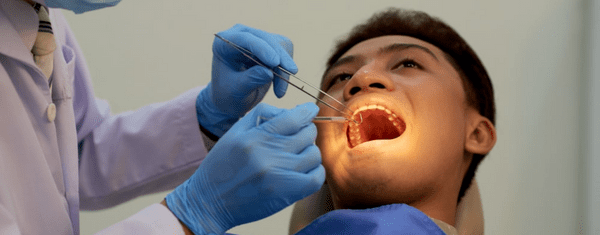 painless tooth extraction in whitefield