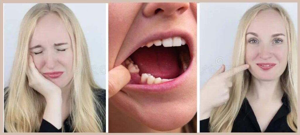 painless tooth extraction in whitefield